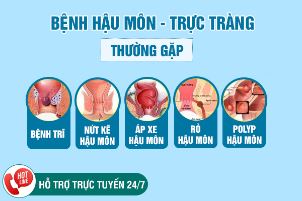 7 bệnh hậu môn thường gặp mà bạn nên biết