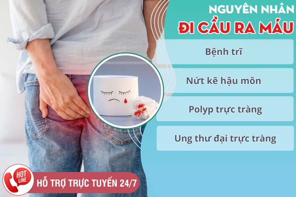 Cách chữa đi cầu ra máu nhanh khỏi, ngăn ngừa tái phát