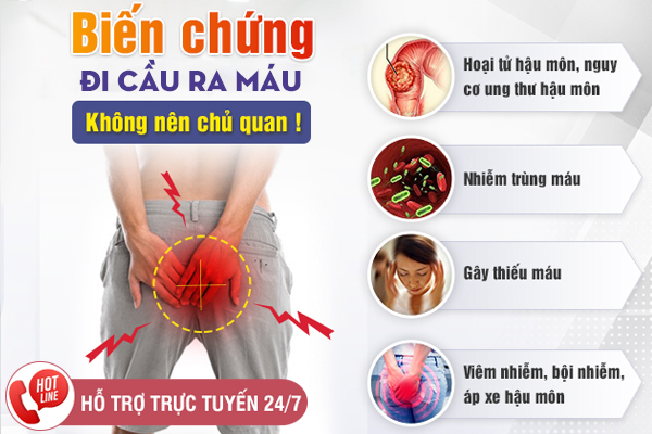 Cách chữa đi cầu ra máu nhanh khỏi, ngăn ngừa tái phát