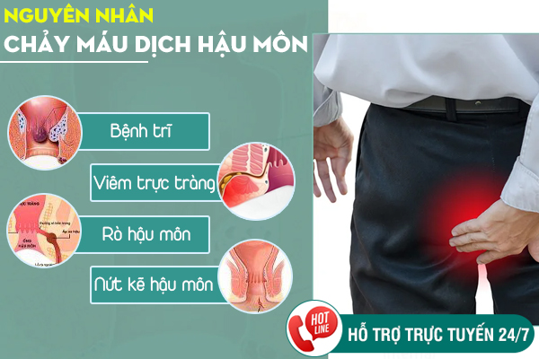 Chảy máu dịch hậu môn - Dấu hiệu cảnh báo bất thường về sức khỏe
