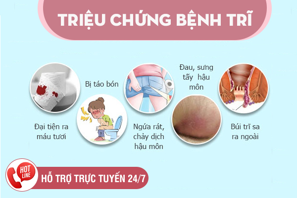 Các phương pháp hỗ trợ chữa bệnh trĩ phổ biến hiện nay