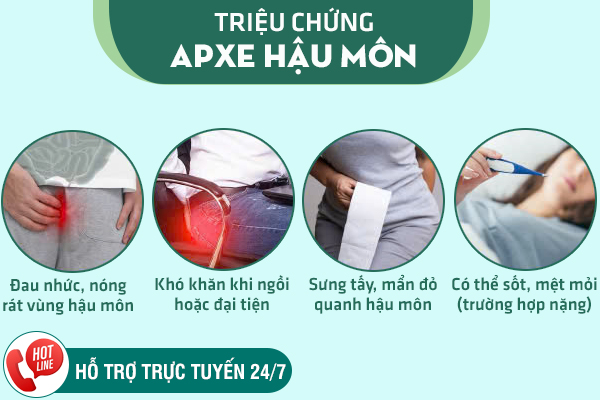 Chữa trị Apxe hậu môn - Phương pháp mới giúp hồi phục nhanh chóng