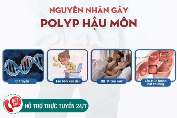 Chữa trị Polyp hậu môn - Phương pháp hiện đại, nhanh khỏi, ít đau