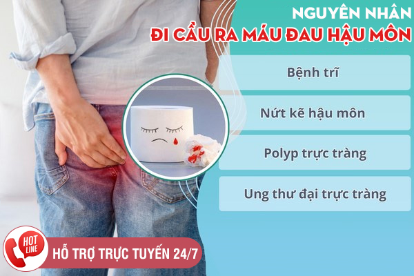 Đi cầu ra máu đau hậu môn - Triệu chứng chớ nên xem thường