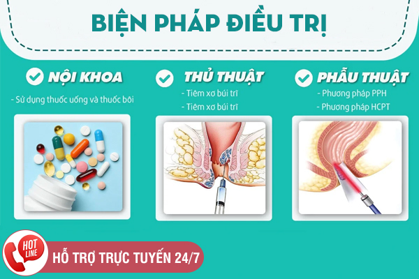 Các phương pháp hỗ trợ chữa bệnh trĩ phổ biến hiện nay