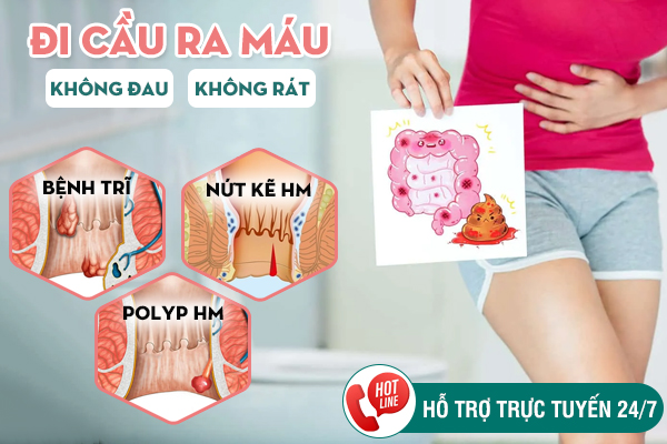 Đi cầu ra máu không đau rát hậu môn - Nguyên nhân và cách chữa trị