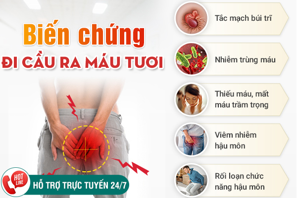Đi cầu ra máu tươi nhỏ giọt - Dấu hiệu chớ xem nhẹ
