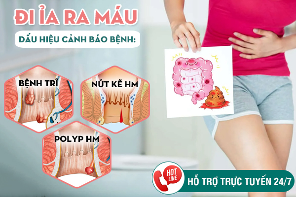 Đi ỉa ra máu là dấu hiệu bệnh gì? Cách xử lý an toàn