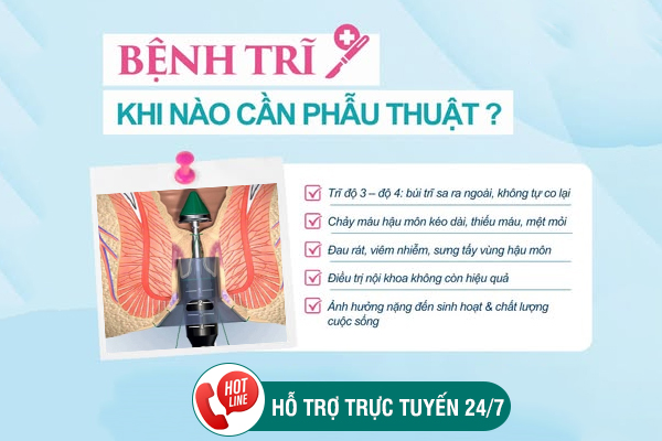 Khi nào cần cắt trĩ? Địa chỉ cắt mổ trĩ uy tín ở Đắk Lắk