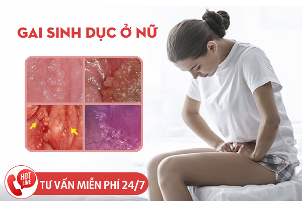 Gai sinh dục ở nữ - Nguyên nhân, dấu hiệu và cách chữa trị