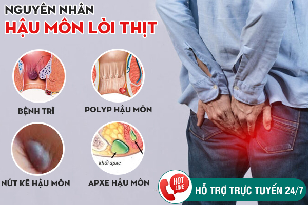 Hậu môn lòi thịt là bị gì? Điều trị ra sao?
