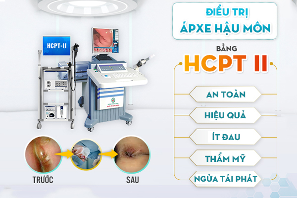 Áp xe hậu môn có tự khỏi không? Địa chỉ khám Apxe hậu môn uy tín