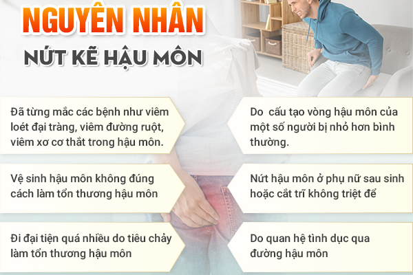 Nứt kẽ hậu môn có tự lành không? Nguyên nhân và biện pháp hỗ trợ điều trị
