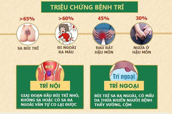 Giới thiệu phòng khám bệnh trĩ đáng tin cậy ở Buôn Ma Thuột