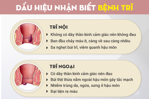 Bệnh trĩ có tự khỏi không? Phương pháp hỗ trợ chữa trị trĩ hiện đại