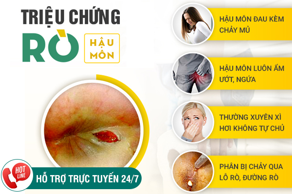 Rò hậu môn - Nguyên nhân, dấu hiệu và cách chữa trị hiệu quả