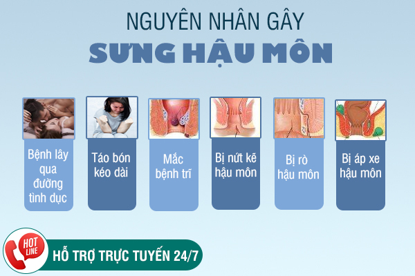 Sưng hậu môn - Triệu chứng không nên xem nhẹ