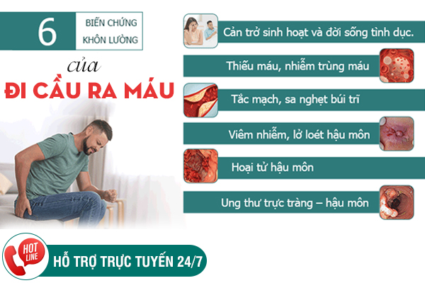 Khám bệnh đi cầu ra máu ở đâu tốt? Gợi ý địa chỉ đáng tin cậy tại Đắk Lắk