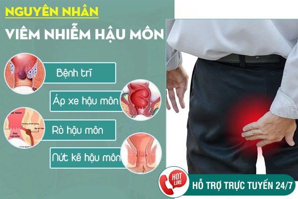 Viêm nhiễm hậu môn - Nguyên nhân, triệu chứng và cách chữa trị