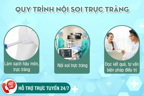 Thời gian xét nghiệm nội soi hậu môn bao lâu? Quy trình thực hiện